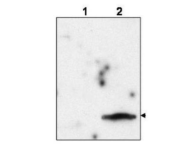 FIV matrix protein p15 Antibody in Western Blot (WB)