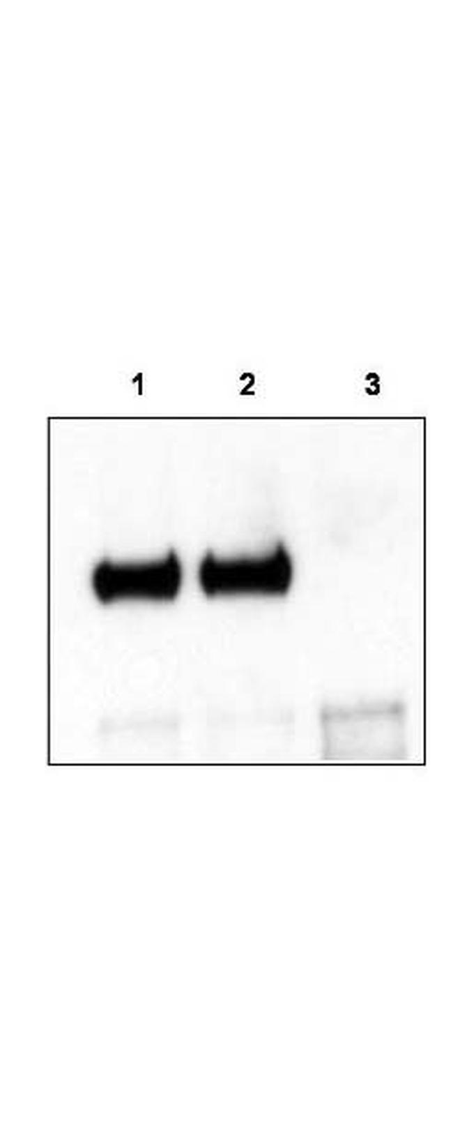 TrkCT1 Antibody in Western Blot (WB)