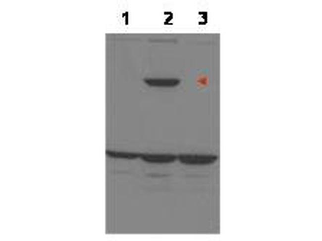 ASPP1 Antibody in Western Blot (WB)