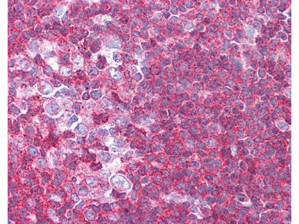 Sipa1 Antibody in Immunohistochemistry (Paraffin) (IHC (P))