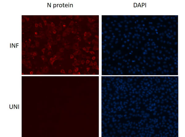 Sars Nucleocapsid Protein Antibody in Immunocytochemistry (ICC/IF)