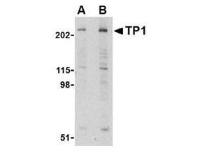 TEP1 Antibody in Western Blot (WB)