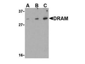 Damage Related Autophagy Modulator Antibody in Western Blot (WB)
