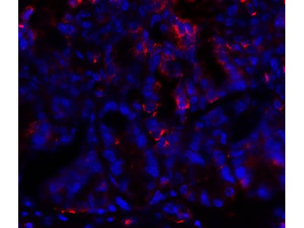 PDL1 Antibody in Immunocytochemistry (ICC/IF)