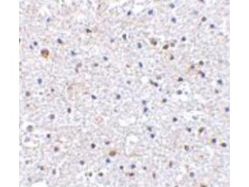 PDCD1 Antibody in Immunohistochemistry (Paraffin) (IHC (P))