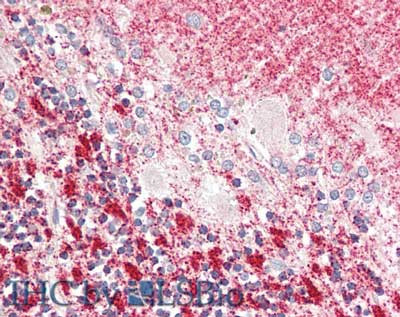 MLF1 Antibody in Immunohistochemistry (Paraffin) (IHC (P))