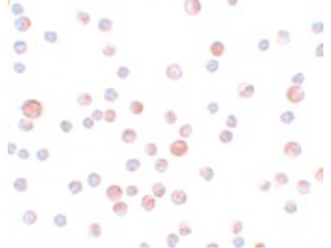 CaBP7 Antibody in Immunocytochemistry (ICC/IF)