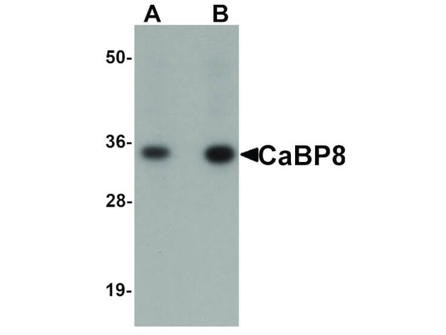 CaBP8 Antibody in Western Blot (WB)