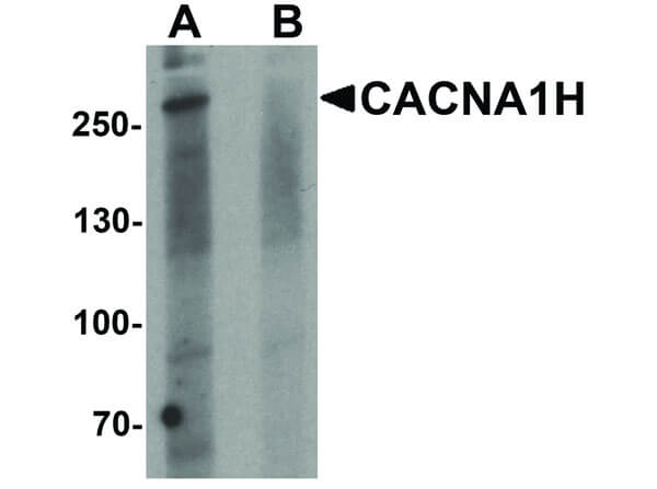 CACNA1H Antibody in Western Blot (WB)