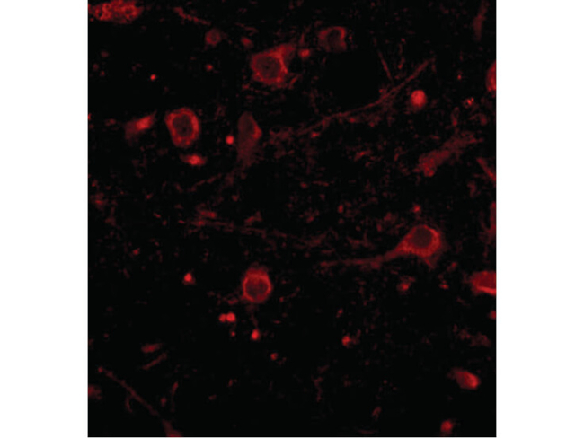 CAPS1 Antibody in Immunocytochemistry (ICC/IF)