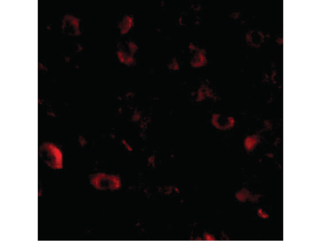 CAPS1 Antibody in Immunocytochemistry (ICC/IF)