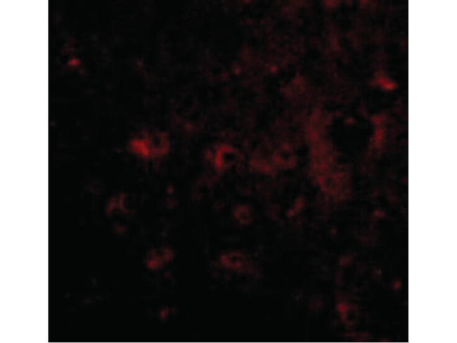 CAPS2 Antibody in Immunocytochemistry (ICC/IF)