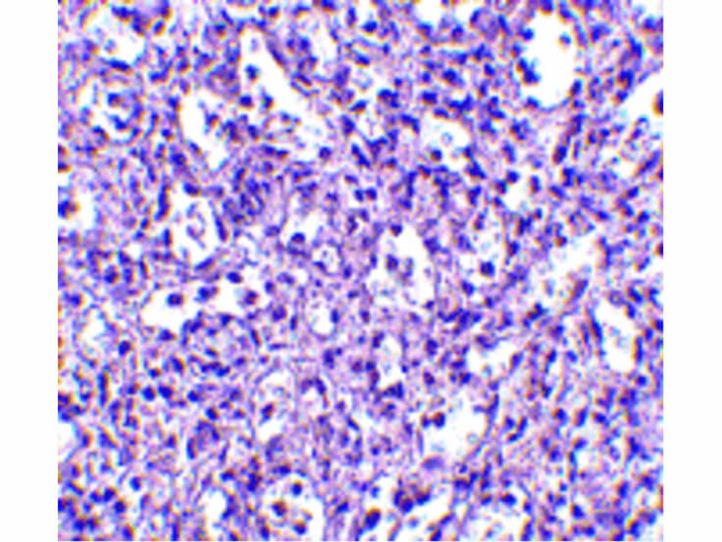 Carabin Antibody in Immunohistochemistry (Paraffin) (IHC (P))