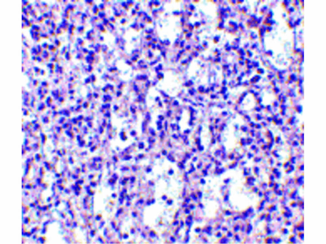 Carabin Antibody in Immunohistochemistry (Paraffin) (IHC (P))