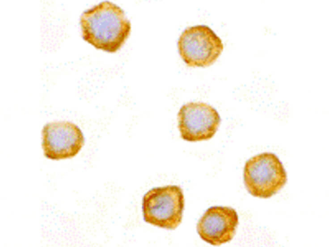 CARD10 Antibody in Immunocytochemistry (ICC/IF)
