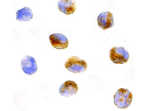 CARD9 Antibody in Immunocytochemistry (ICC/IF)
