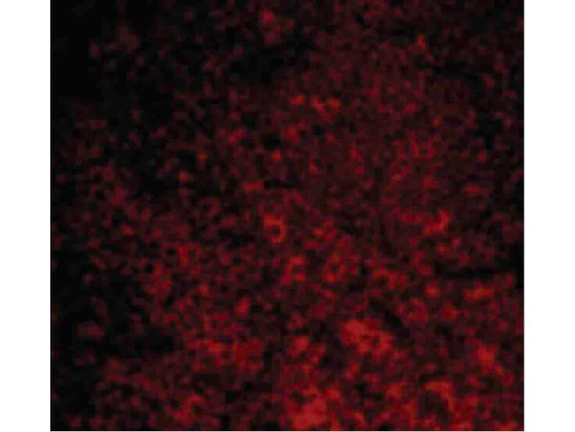 CARMA1 Antibody in Immunocytochemistry (ICC/IF)