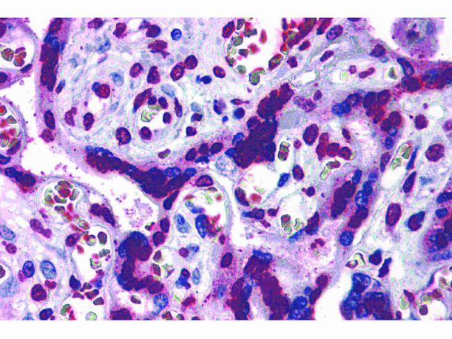 CARMA2 Antibody in Immunohistochemistry (Paraffin) (IHC (P))