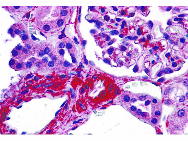 CARMA3 Antibody in Immunohistochemistry (Paraffin) (IHC (P))