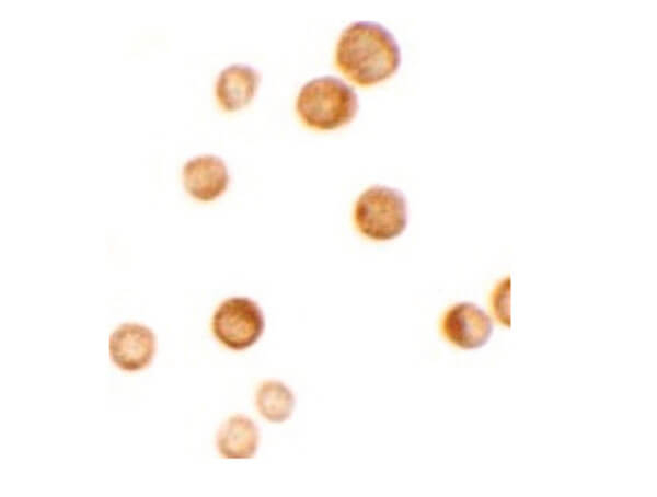 CASKIN2 Antibody in Immunocytochemistry (ICC/IF)