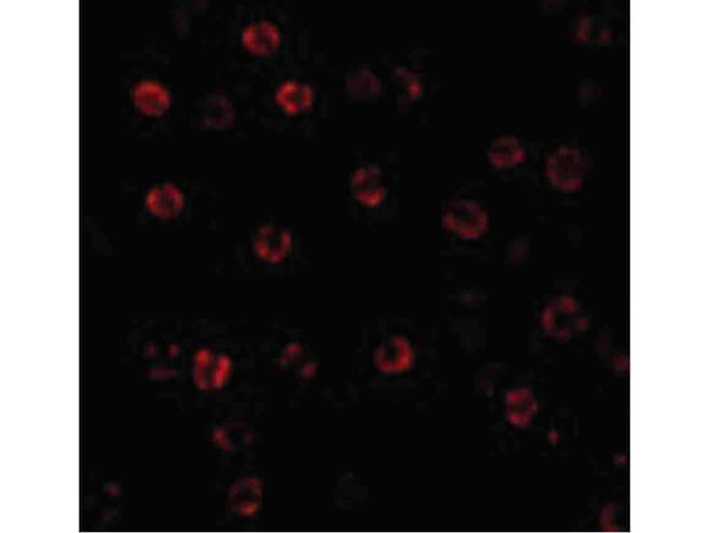 Caspase-1 Antibody in Immunocytochemistry (ICC/IF)