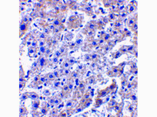 Caspase-14 Antibody in Immunohistochemistry (Paraffin) (IHC (P))