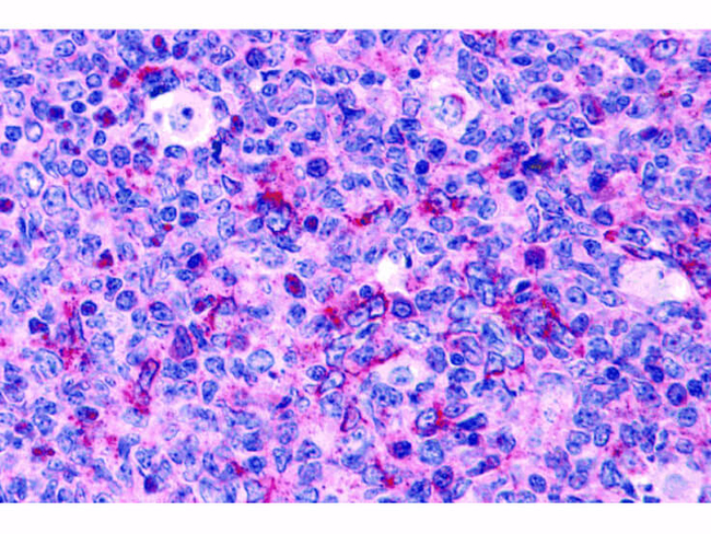 Caspase-3 Antibody in Immunohistochemistry (Paraffin) (IHC (P))