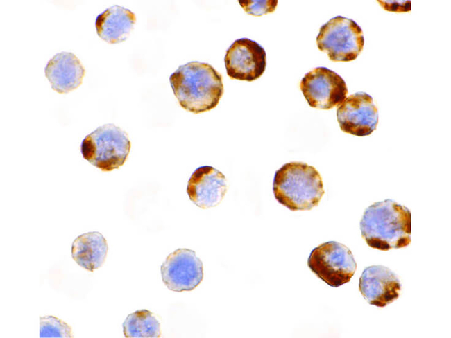 Caspase-6 Antibody in Immunocytochemistry (ICC/IF)