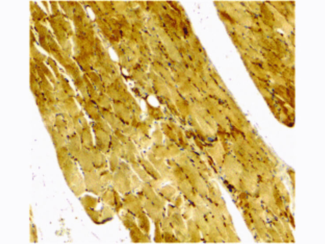 Caspase-7 Antibody in Immunohistochemistry (Paraffin) (IHC (P))