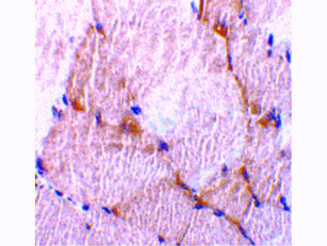 Caspase-7 Antibody in Immunohistochemistry (Paraffin) (IHC (P))
