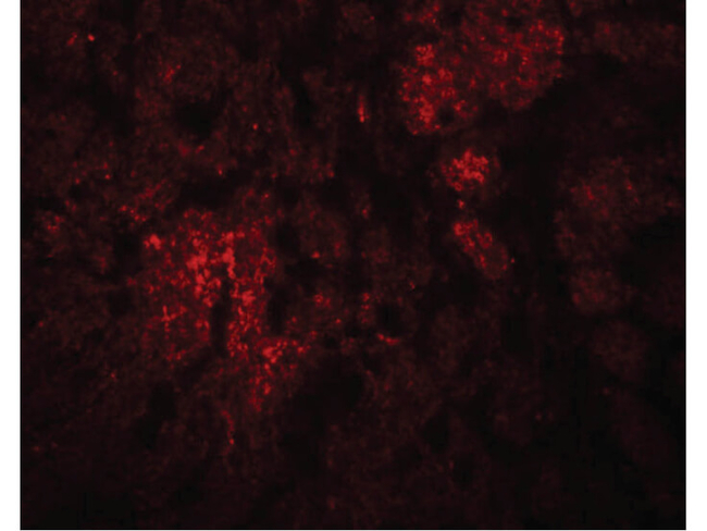 CCDC106 Antibody in Immunocytochemistry (ICC/IF)
