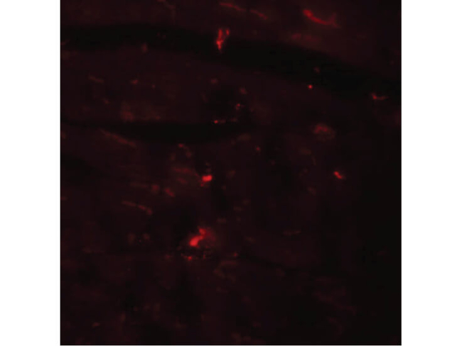 CCDC47 Antibody in Immunocytochemistry (ICC/IF)