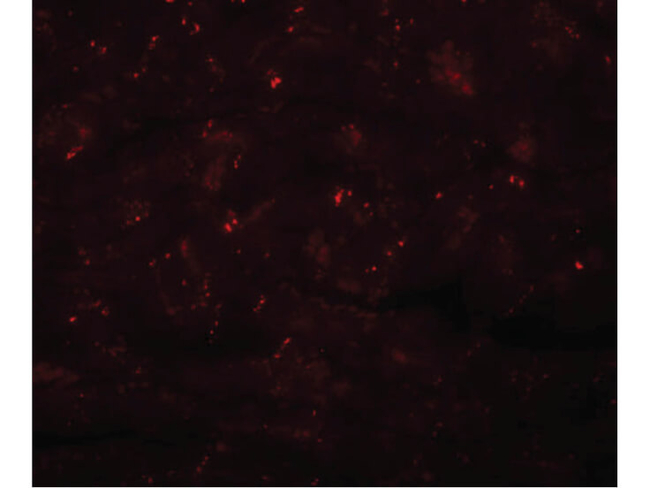CCDC47 Antibody in Immunocytochemistry (ICC/IF)