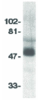 CCR8 Antibody in Western Blot (WB)