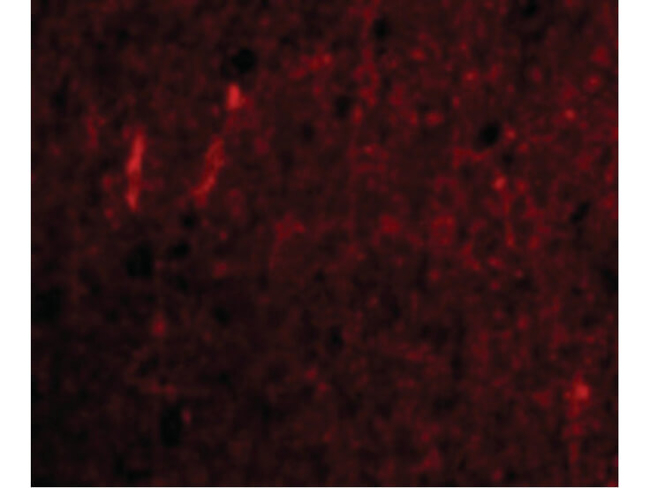 CDNF Antibody in Immunocytochemistry (ICC/IF)