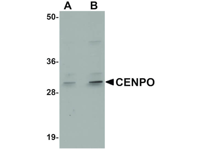 CENPO Antibody in Western Blot (WB)