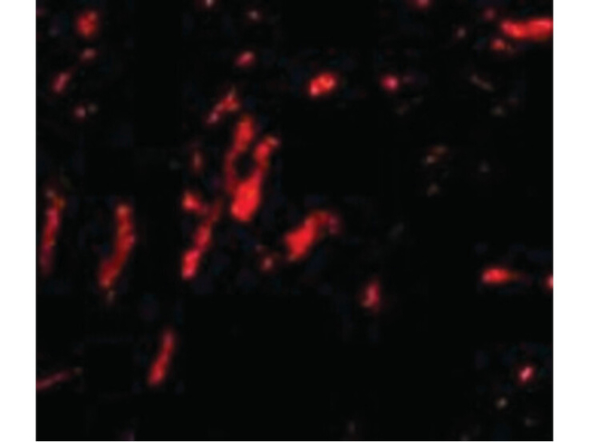 CDCA8 Antibody in Immunocytochemistry (ICC/IF)