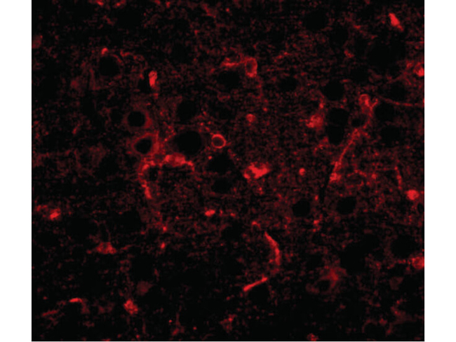 CDIP Antibody in Immunocytochemistry (ICC/IF)