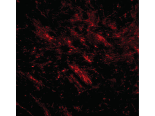 CDIP Antibody in Immunocytochemistry (ICC/IF)