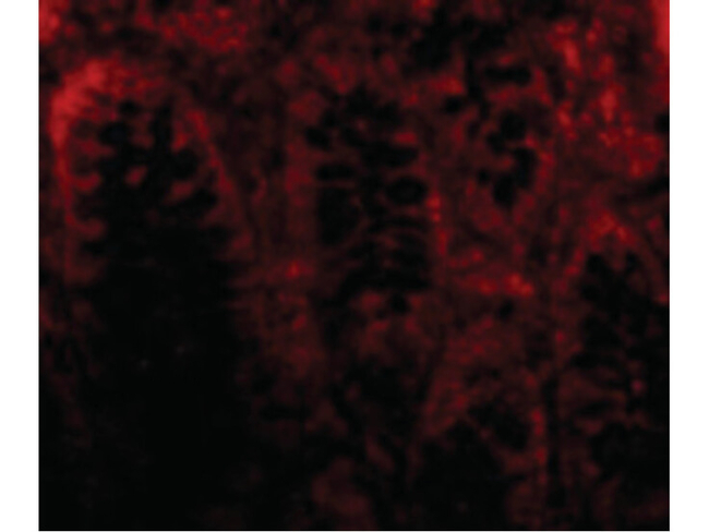 CDKN2A Antibody in Immunocytochemistry (ICC/IF)