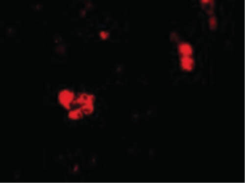 CIDE-B Antibody in Immunocytochemistry (ICC/IF)