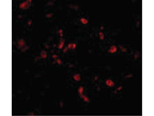 CIKS Antibody in Immunocytochemistry (ICC/IF)