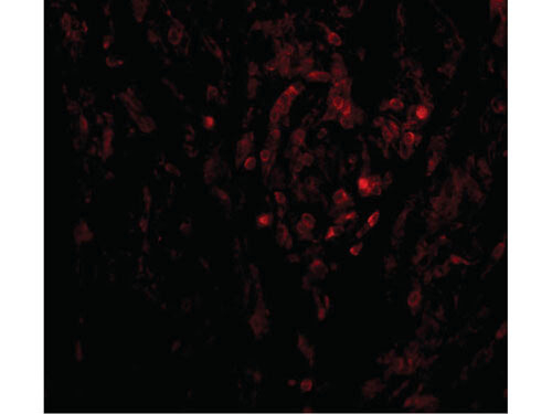 CIKS Antibody in Immunocytochemistry (ICC/IF)