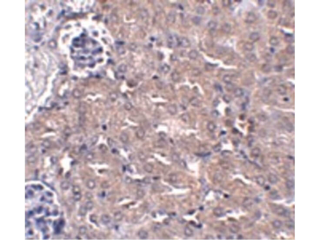 CIP75 Antibody in Immunohistochemistry (Paraffin) (IHC (P))