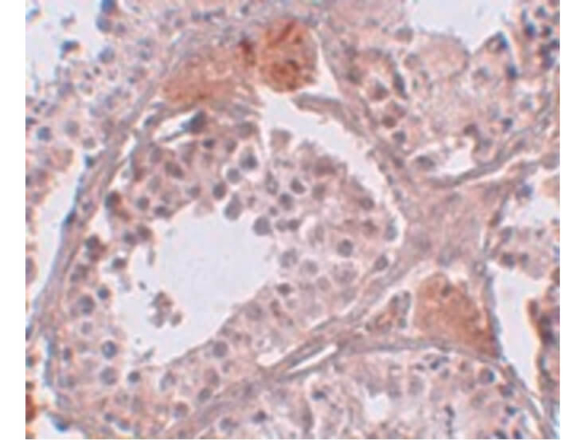 CLPH Antibody in Immunohistochemistry (Paraffin) (IHC (P))