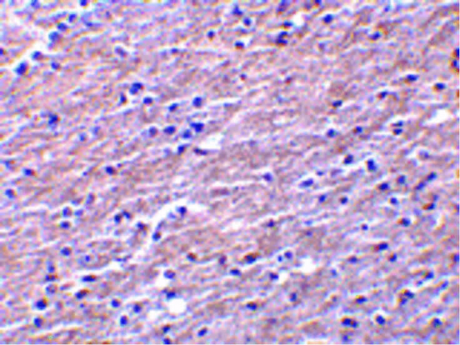 Clusterin Antibody in Immunohistochemistry (Paraffin) (IHC (P))