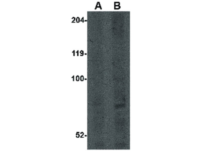 CNOT4 Antibody in Western Blot (WB)