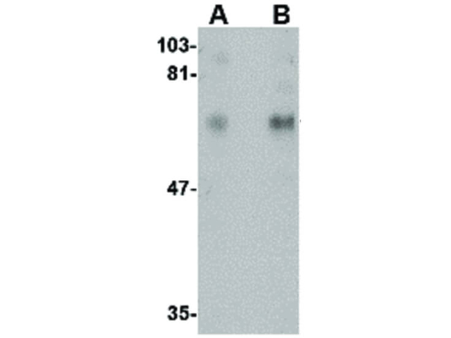 CPEB1 Antibody in Western Blot (WB)