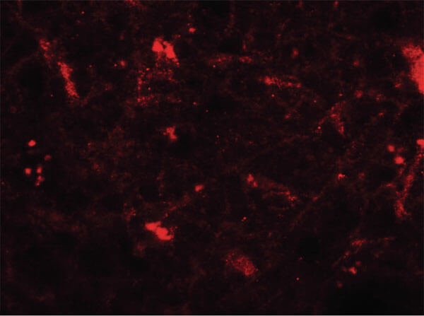 CRH Antibody in Immunocytochemistry (ICC/IF)