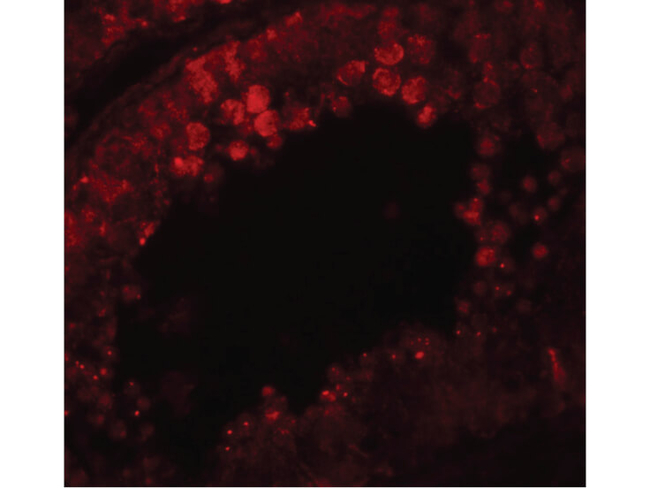 CRISP2 Antibody in Immunocytochemistry (ICC/IF)